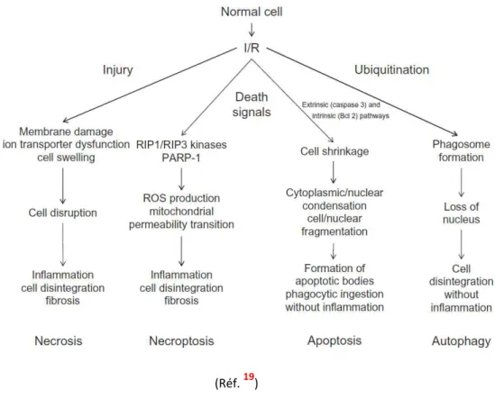 Figure 10.  Schéma des principaux mécanismes de la mort cellulaire induite par l’ischémie reperfusion :  nécrose, nécroptose, apoptose et autophagie.
