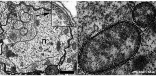 Figure  4 .  Image  de  gauche :  Cellule  neuronale  de  D.  melanogaster  infectée  par Wolbachia,  avec  zoom  sur  les  trois  parois  de  la  bactérie
