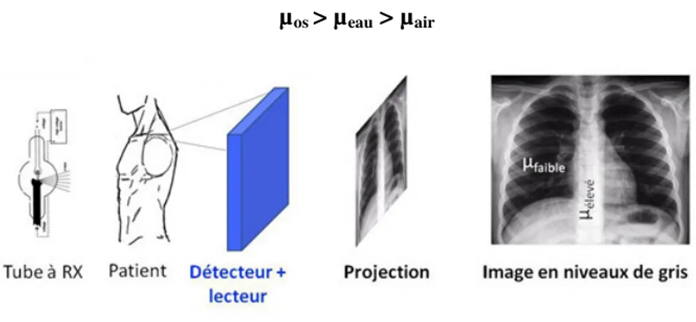 Figure II.3 : Principe de l’acquisition d’une radiographie   La qualité de l’image dépend de 2 facteurs : 