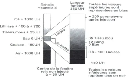 Figure II.6 : Echelle des densités de tissus pour la TDM, en unités Hounsfield (UH). 