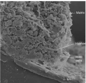 Figure  9 :  Section  transversale  d’un  biofilm  de  C.  albicans  à  l’intérieur  de  la  lumière  d’un  cathéter  vasculaire  implanté  chez  un  rat  (épaisseur  supérieure  à  200µ M ;  Grossissement x 1000) (Nett and Andes, 2006).