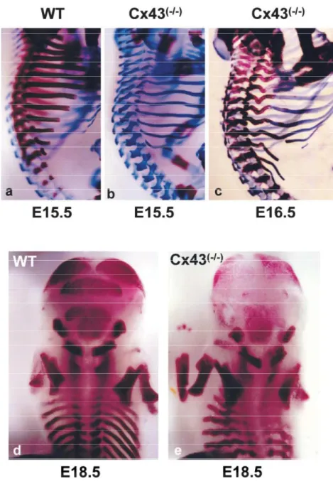 Figure 23 : Effet de la délétion du gène de la Cx43 sur le développement axial chez la souris.