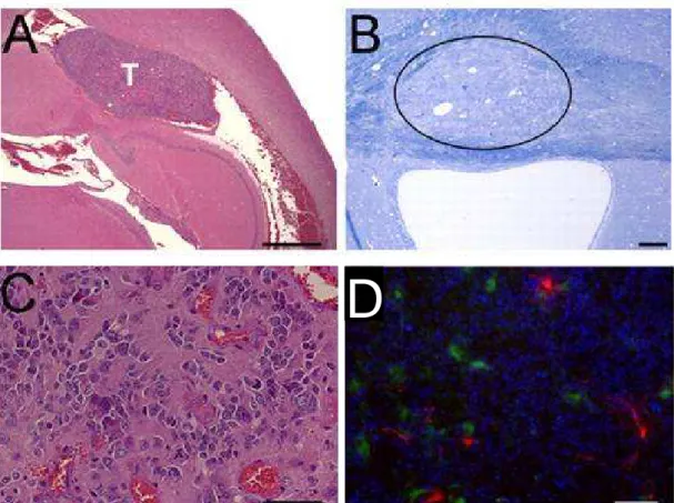 Figure  14 :  Les  tumeurs  de  type  glioblastome  sont  détectées  dans  les  zones  périventriculaires  chez  des  souris adultes p53 -/-  qui ont été exposées au mutagène ENU