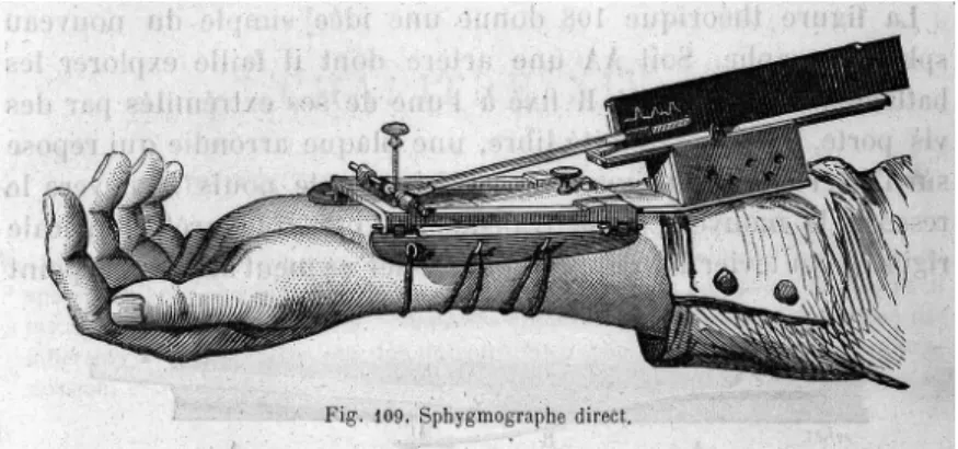 Figure 2. Sphygmographe, un des premiers dispositifs de  psychographie