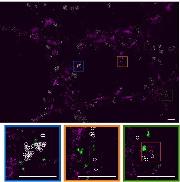 Figure 3 – Colocalization of BDNF and vGlut proteins in dSTORM images. DSTORM acquisition of cells from hippocampi of mice expressing BDNF proteins (green channel) and vGlut (purple channel) [13], with three zoomed-in regions displayed at the bottom