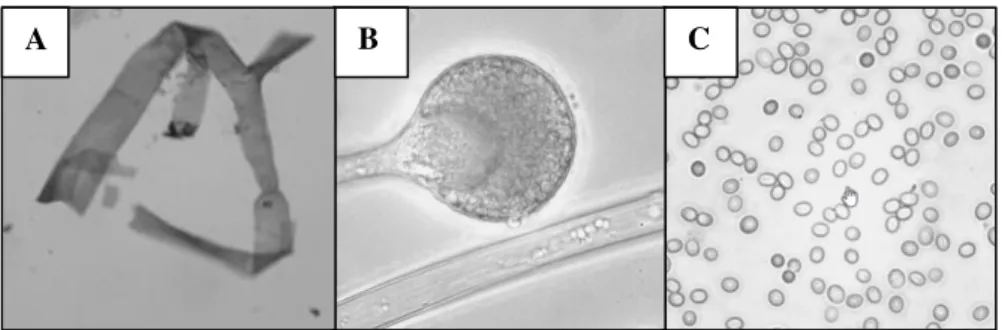 Figure 1 : A - Filaments de Mucorales (x 400). B - Organe de production des spores : sporange porté par  un sporangiophore (x 400)