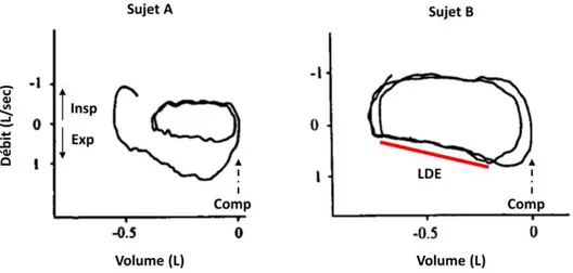 Figure  7.  Courbes  débit-volume  d’un  cycle  ventilatoire  spontané  suivi  d’une  expiration  assistée  par  une  compression  abdominale manuelle (Comp) (modifié de Ninane et al., 2001)