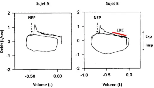 Figure 8. Courbes débit-volume d’un cycle ventilatoire spontané suivi d’une expiration assistée par une pression expiratoire  négative (NEP, dont l’application est matérialisée par la flèche discontinue) (modifié de  Eltayara et al., 1996)