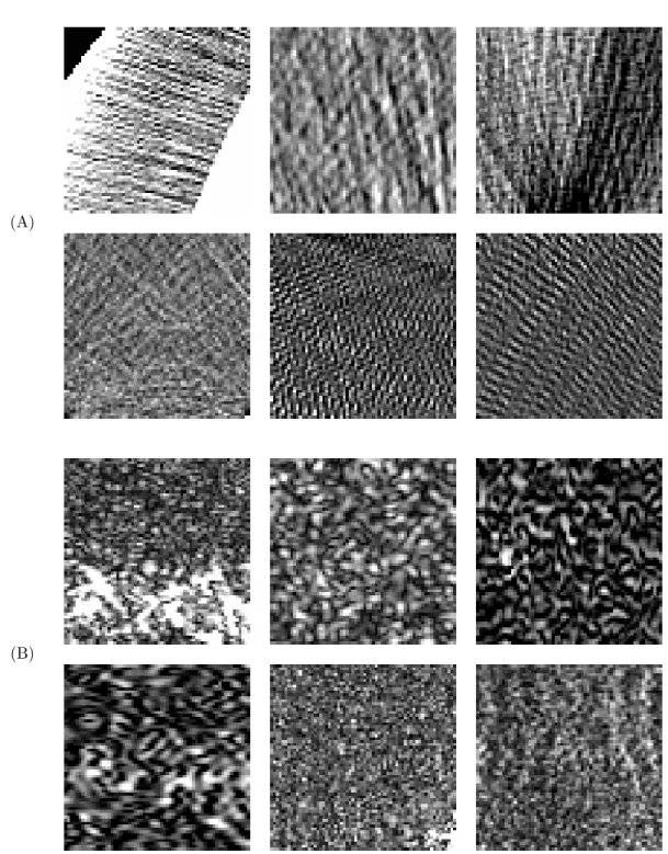 Fig. 6.2 – Patchs illustrant le type de bruit pr´esent sur les tomographies (A) et les IRMs (B)