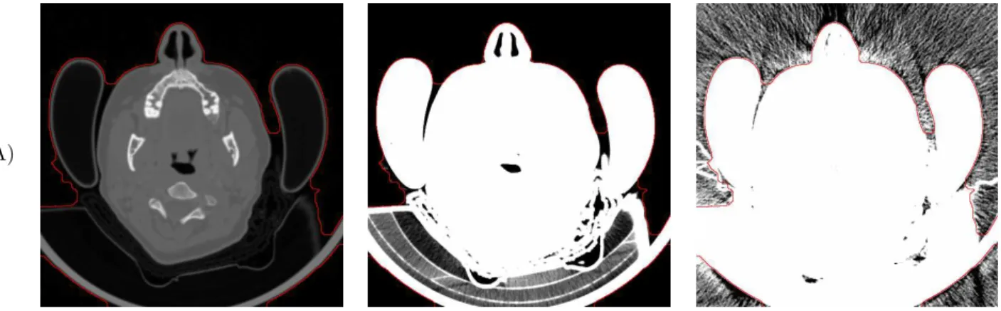 Fig. 6.7 – Illustration de la localisation de la r´egion d’int´erˆet d´efinie par le masque B ROI k de l’image (A) (cf