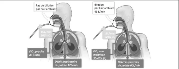 Figure 3. A  gauche, situation de repos : le débit inspiratoire du patient de 12 L/min environ est couvert par le  débit d’oxygène administré de 15 L/min  dans  le  masque