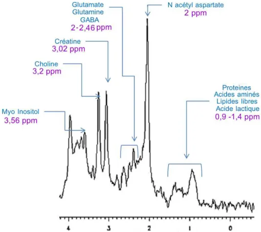 Figure 2.8 – Exemple d’un spectre proton `a TE court pr´esentant les raisonnance des principaux m´etabolites c´er´ebraux (source [58] avec droits de reproduction).