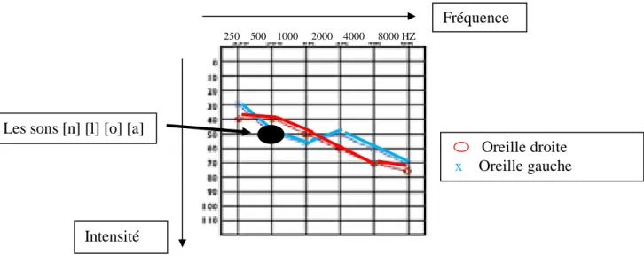 Figure 50 (Perception de sons par un sourd de l'établissement / source : enfant de la classe)  L’individu  sourd  oraliste  mobilise  sa  capacité  auditive  pour  mieux  recevoir  les  phonèmes de la langue orale