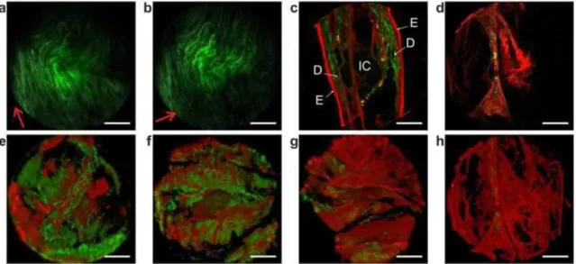 Figure 2.8 – Label-free microendoscopy images of fixed tissue samples ex vivo [31].