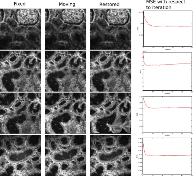 Figure 4.5 – Spectral Demons method on microendoscopic images