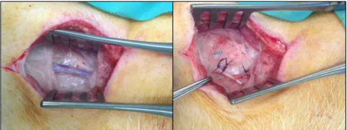 Figure 15: La veine jugulaire externe gauche avant (gauche) et après (droite) la mise en place le  cathéter 