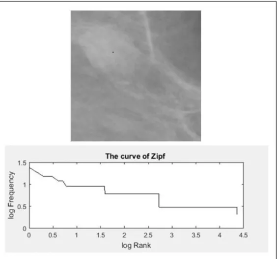 Fig II.4: image 12-B de la base MIAS et la courbe Zipf correspondant. 