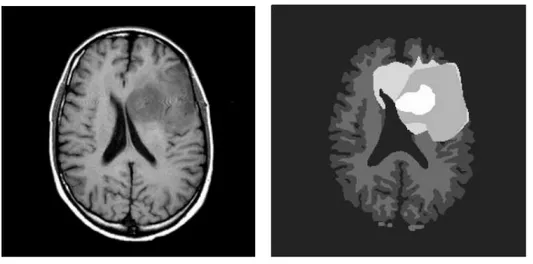 Fig. 8 – Segmentation par SVM - tir´ e de [101]