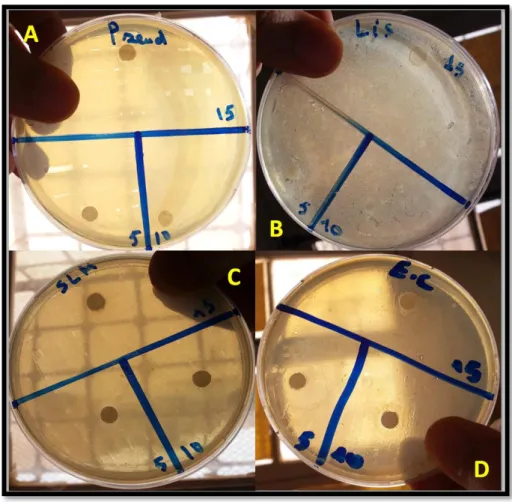 Figure 13. Photos montrentles zones d’inhibition des différentes souches bactériennes