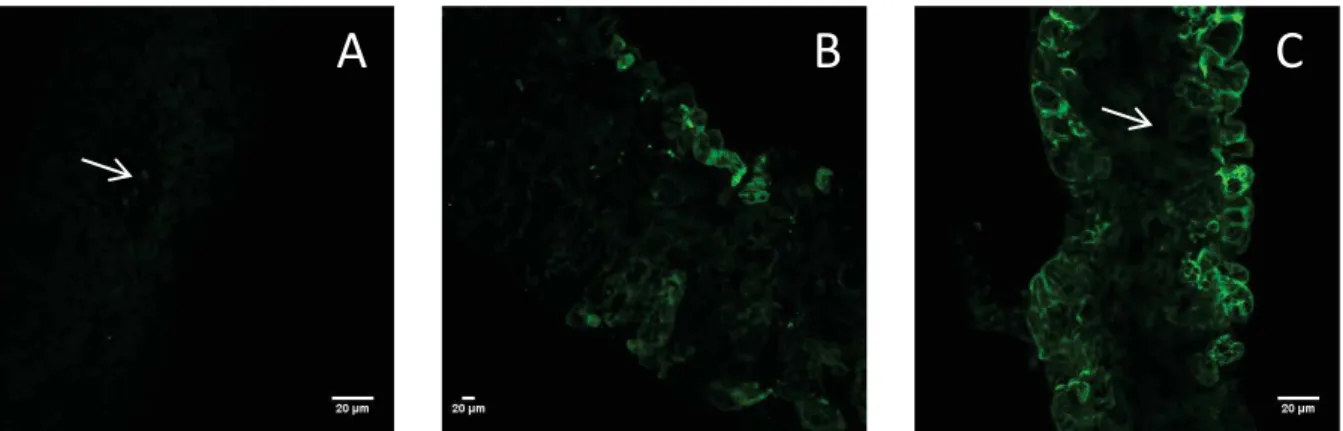 Figure 10: Répartition du CMV (vert) dans un protoplaste (A) issu d une plante 20 jours après inoculation et (B) issu de la même plante 34 jours après inoculation