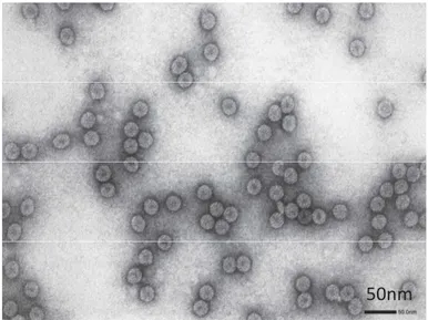 Figure 2:  bservation d une purification du CMV au microscope électronique à transmission(photo fourni par  Daniel Gargani)