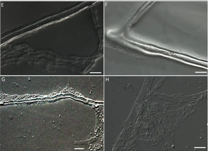Figure 5.  Bacterial growth patterns on  G. irregulare  hyphae cultivated  in vitro observed  with a DIC  microscope using a 63X  objective