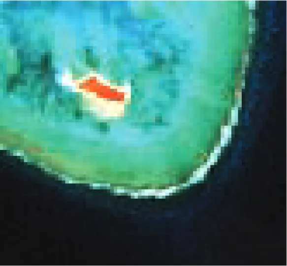 Figure 1.    Zoom sur l'îlot Loop de l'image Landsat n° RNL71087074_07419990906  du récif  des Chesterfield (Millenium Coral Reef  Mapping Project : Andréfouët et al