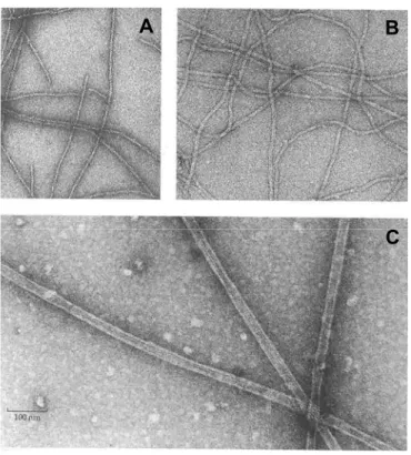 Figure 1.1  : Micrographies obtenues par microscopie électronique à  transmission dans lesquelles nous pouvons voir : (A) Les filaments d’actine, d’un  diamètre d’environ 6 nm ; (B) Les filaments intermédiaires de 10 nm de diamètre et  ayant une courbure p