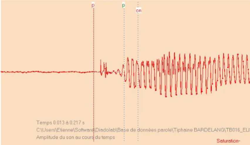 Figure 18 : Allure temporelle du /b/ de /bonjour/, perçu comme /p/ (TB016) 