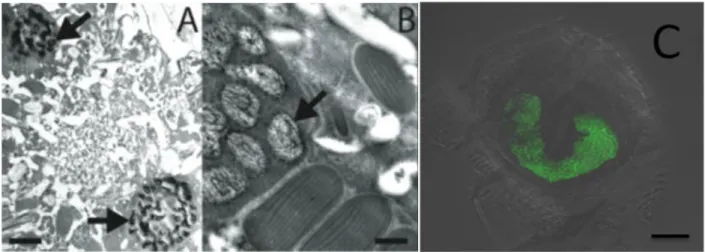 Figure 1 : Les chromosomes des dinoflagellés sont condensés. (A et B) Des cellules de  Lingulodinium  polyedrum, récoltées à l'interphase, fixées au glutaraldéhyde et colorées à  l'acétate d'uranyle, sont photographiées au microscope électronique