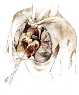 Figure 2 : L’injection des vaisseaux. ©  Emmanuel Bastid – Ecole Estienne 