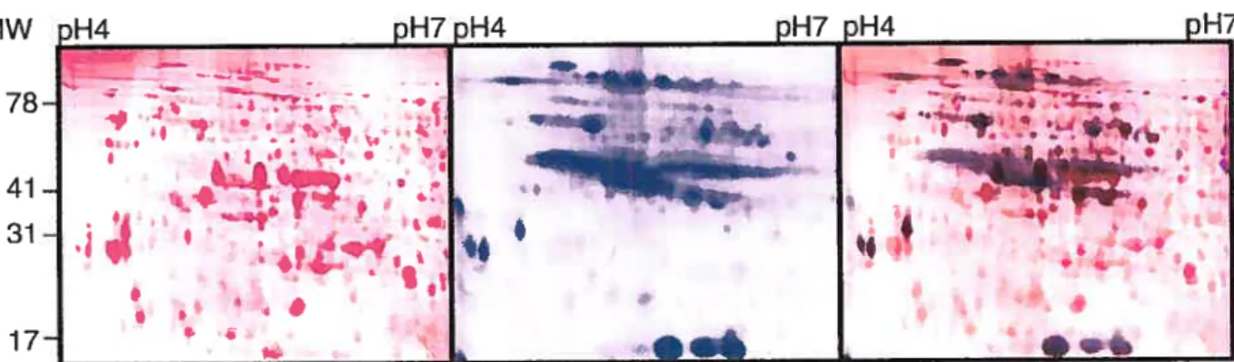 Figure 2: Comparison of the 2-DE patterns obtaineil from 32P-IabelIing and Sypro Ruby (total protein) staining