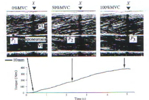 Fig. 3: Images ultrasoniques d’une section longitudinale du muscle vastus  lateralis durant une contraction isométrique à 0, 50 et 100% du MVC