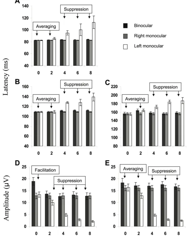 Fig. 1 Patterns of binocular interaction according to VEP’s latencies and amplitude.  Top; N75  latency,  Middle;  (Left)  P100  latency  and  (right)  N150  latency,  Bottom;  (Left)  N75-P100  amplitude and (right) P100-N150 amplitude