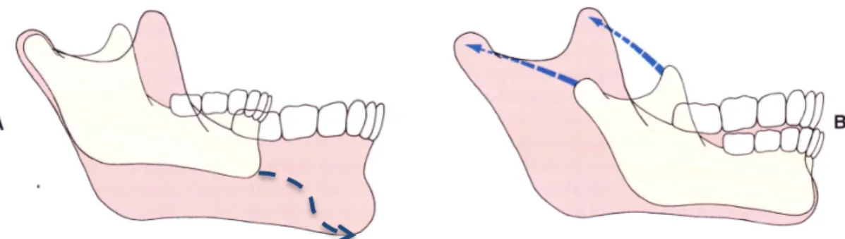 Figure   7   :   A,   Croissance   de   la   mandibule   par   rapport   à   la   base   crânienne   :   le   menton   se   dirige    vers   l’avant   et   vers   le   bas
