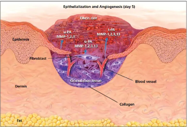Figure  2  :  Illustration  d'une  plaie  cutanée  pleine  épaisseur  5  jours  après  le  trauma  montrant  l'angiogénèse, la fibroplasie et l'épithélialisation