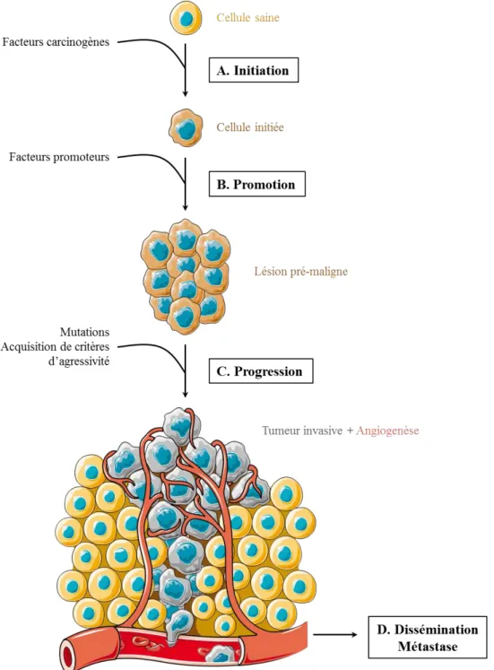 Figure  3.  Représentation  de  la  carcinogenèse.  (A)  Suite  à  une  mutation  spontanée  ou  à  l’exposition à des facteurs carcinogènes, une cellule normale acquière des altérations génétiques  irréversibles