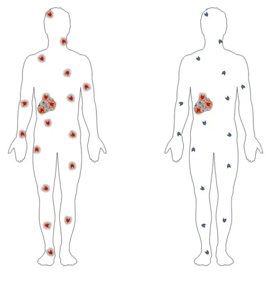 Figure 5. Les chimiothérapies classiques affectent sans discrimination les cellules cancéreuses et  les cellules saines (à gauche)