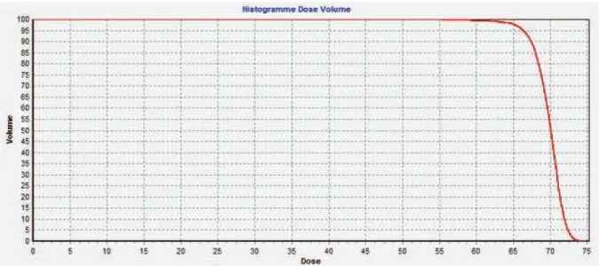 Figure 13 : Exemple d’un HDV cumulatif d’un PTV recevant une dose totale de 70 Gy.  