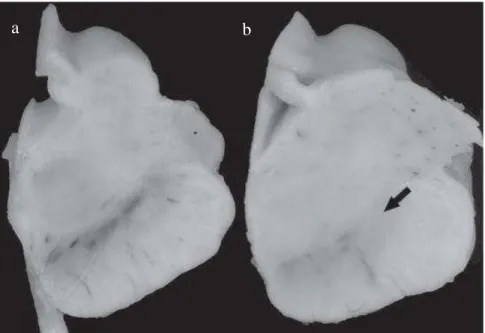 Figure 1. Depigmentation of the SN in PD. A transverse section of the midbrain at the  level of the third nerve in (a) a normal elderly individual and (b) a patient with PD