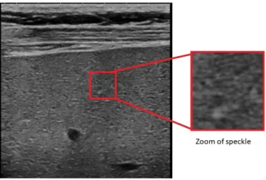 Figure 2.3: Clinical ultrasound image corrupted with speckle