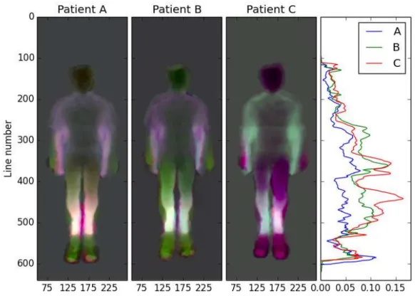 Fig. 2.2: Asymmetry map for subject #15, one of the best result of the dataset.