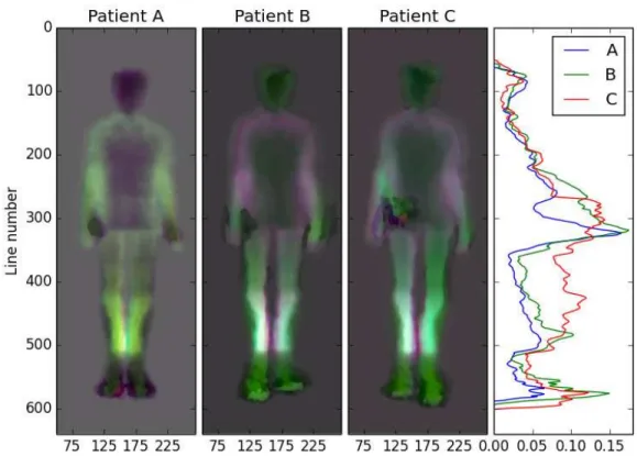 Fig. 2.3: Asymmetry map for subject #05, one of the best result of the dataset.