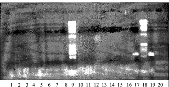 Tableau III : Nombre d'isolats d'Enferococcus provenant du deuxième essai  de l'étude dans lesquels on  détecte le gène vatD par PCR