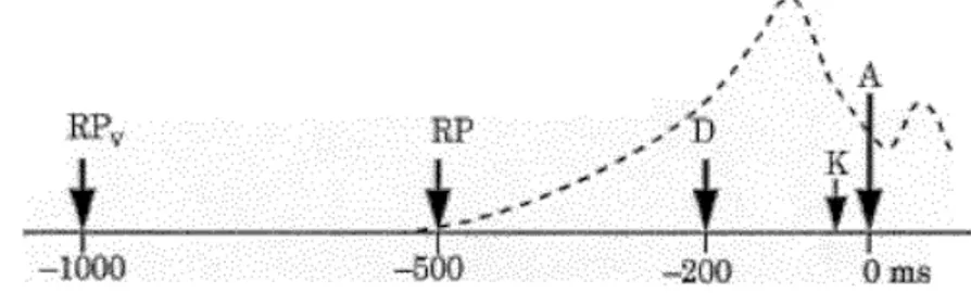 Figure 1 : Électroencéphalographe enregistré lors de l’expérience de Libet 