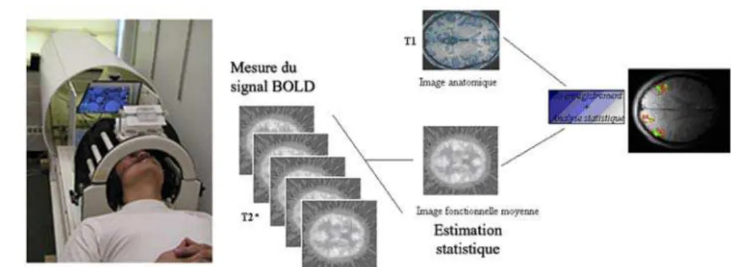 Figure 12 : Réalisation d’une IRM fonctionnelle