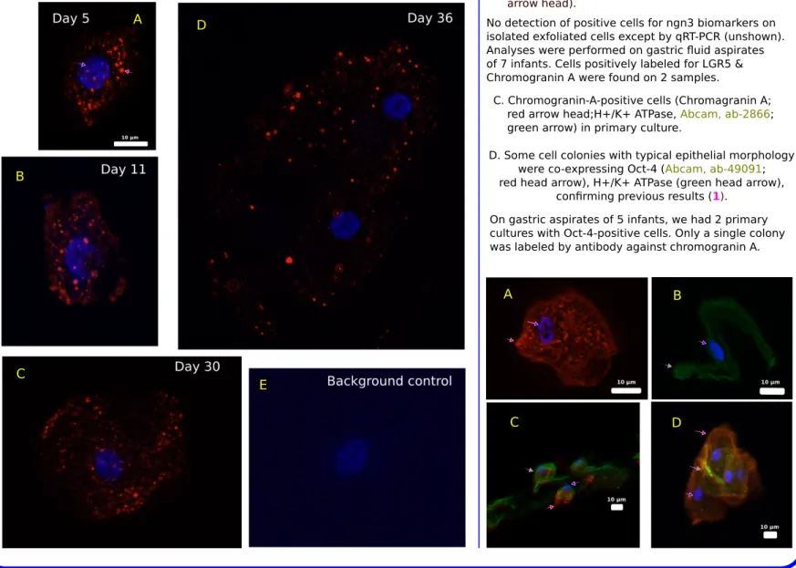 Figure 1. NPAS2 expression in gastric exfoliated cells.