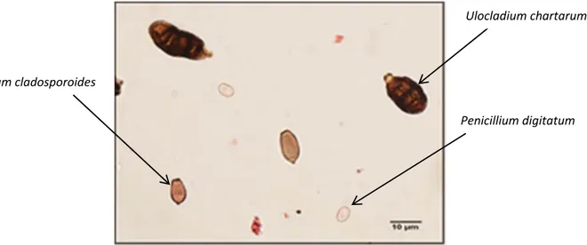 Figure 5. Photographie des spores au microscope (1600X) 
