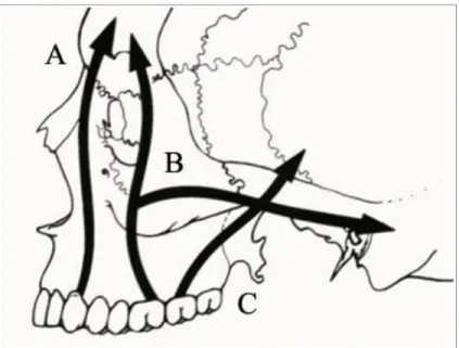 Figure 4 : Les principaux sites de résistance aux forces d’EP : les apophyses piriformes (A),  les apophyses zygomatiques (B), les jonctions ptérygo-maxillaires (C) 
