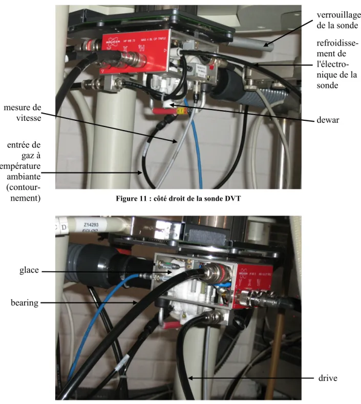 Figure 11 : côté droit de la sonde DVT 